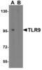 Toll-like receptor 9 antibody, NBP1-76680, Novus Biologicals, Western Blot image 