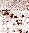 Ubiquitin C-Terminal Hydrolase L1 antibody, MBS438216, MyBioSource, Immunohistochemistry paraffin image 