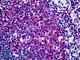 SUFU Negative Regulator Of Hedgehog Signaling antibody, LS-B5105, Lifespan Biosciences, Immunohistochemistry frozen image 