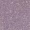 Zinc Finger Matrin-Type 3 antibody, HPA027569, Atlas Antibodies, Immunohistochemistry paraffin image 