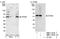 Vacuolar Protein Sorting 4 Homolog B antibody, NBP1-19119, Novus Biologicals, Western Blot image 