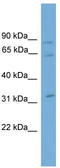 Calpain 11 antibody, TA340149, Origene, Western Blot image 