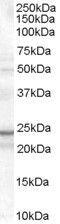 TIR Domain Containing Adaptor Protein antibody, GTX89359, GeneTex, Western Blot image 