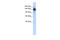 RNA Binding Motif Protein 6 antibody, 25-013, ProSci, Western Blot image 