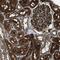 PHD Finger Protein 11 antibody, PA5-53477, Invitrogen Antibodies, Immunohistochemistry paraffin image 