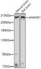 Ankyrin Repeat And KH Domain Containing 1 antibody, GTX32441, GeneTex, Western Blot image 