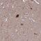 Centrosomal Protein 41 antibody, NBP1-92538, Novus Biologicals, Immunohistochemistry paraffin image 