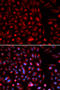 Axin 2 antibody, STJ26209, St John