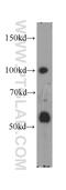 5'-3' Exoribonuclease 2 antibody, 11267-1-AP, Proteintech Group, Western Blot image 