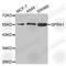 GDNF Family Receptor Alpha 1 antibody, A5373, ABclonal Technology, Western Blot image 