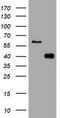 Phosphatidylinositol-4-Phosphate 3-Kinase Catalytic Subunit Type 2 Alpha antibody, TA801725BM, Origene, Western Blot image 
