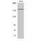 Erb-B2 Receptor Tyrosine Kinase 3 antibody, LS-C383412, Lifespan Biosciences, Western Blot image 