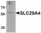 Solute Carrier Family 29 Member 4 antibody, NBP2-41314, Novus Biologicals, Western Blot image 