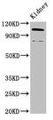 Actinin Alpha 4 antibody, CSB-PA00819A0Rb, Cusabio, Western Blot image 