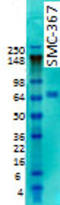 Potassium Voltage-Gated Channel Subfamily D Member 2 antibody, TA326559, Origene, Western Blot image 