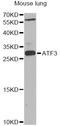 Activating Transcription Factor 3 antibody, STJ22703, St John