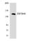 Zinc Finger And BTB Domain Containing 40 antibody, LS-C292211, Lifespan Biosciences, Western Blot image 