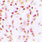 Checkpoint Kinase 2 antibody, LS-C354626, Lifespan Biosciences, Immunohistochemistry frozen image 