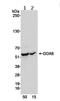 DEAD-Box Helicase 6 antibody, ab70455, Abcam, Western Blot image 