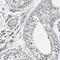 Myoferlin antibody, PA5-53134, Invitrogen Antibodies, Immunohistochemistry frozen image 