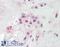 Solute Carrier Family 12 Member 2 antibody, 42-498, ProSci, Immunohistochemistry frozen image 