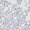 Surfactant Protein C antibody, 18-339, ProSci, Immunohistochemistry frozen image 