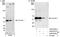 TACO antibody, A300-930A, Bethyl Labs, Western Blot image 