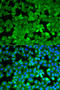 Asparagine Synthetase (Glutamine-Hydrolyzing) antibody, STJ27504, St John