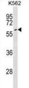 EYA Transcriptional Coactivator And Phosphatase 2 antibody, abx029278, Abbexa, Western Blot image 