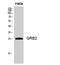 Growth Factor Receptor Bound Protein 2 antibody, STJ93421, St John