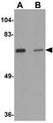 Leucine-rich repeat transmembrane neuronal protein 2 antibody, GTX32002, GeneTex, Western Blot image 