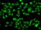 Nuclear Receptor Subfamily 2 Group C Member 1 antibody, GTX65892, GeneTex, Immunocytochemistry image 