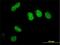 SURP And G-Patch Domain Containing 2 antibody, H00010147-M01, Novus Biologicals, Immunocytochemistry image 