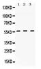 Transforming Growth Factor Beta Receptor 1 antibody, PB10101, Boster Biological Technology, Western Blot image 