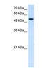Solute Carrier Family 25 Member 25 antibody, NBP1-59870, Novus Biologicals, Western Blot image 