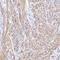 Tropomyosin alpha-1 chain antibody, HPA000261, Atlas Antibodies, Immunohistochemistry paraffin image 