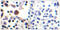 Interleukin 9 Receptor antibody, LS-C117965, Lifespan Biosciences, Immunohistochemistry paraffin image 