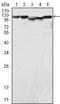 Lysine Demethylase 1A antibody, GTX83263, GeneTex, Western Blot image 