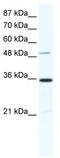 Zinc Finger Protein 610 antibody, TA341514, Origene, Western Blot image 