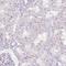 Prolactin antibody, NBP2-59010, Novus Biologicals, Immunocytochemistry image 