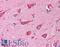 Neurofibromin 1 antibody, LS-B217, Lifespan Biosciences, Immunohistochemistry paraffin image 