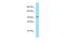 RNA Binding Motif Protein 25 antibody, PA5-69104, Invitrogen Antibodies, Western Blot image 