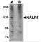 NLR Family Pyrin Domain Containing 5 antibody, MBS150106, MyBioSource, Western Blot image 