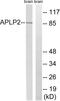 Amyloid Beta Precursor Like Protein 2 antibody, LS-C198635, Lifespan Biosciences, Western Blot image 