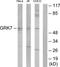 G Protein-Coupled Receptor Kinase 7 antibody, TA316104, Origene, Western Blot image 
