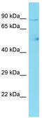 Coiled-Coil Domain Containing 142 antibody, TA333606, Origene, Western Blot image 