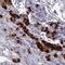 Neuronal Pentraxin 2 antibody, NBP2-38609, Novus Biologicals, Immunohistochemistry paraffin image 