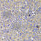 Heat Shock Protein Family A (Hsp70) Member 14 antibody, A7107, ABclonal Technology, Immunohistochemistry paraffin image 