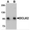 Doublecortin Like Kinase 2 antibody, MBS150733, MyBioSource, Western Blot image 