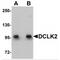 Serine/threonine-protein kinase DCLK2 antibody, MBS150733, MyBioSource, Western Blot image 